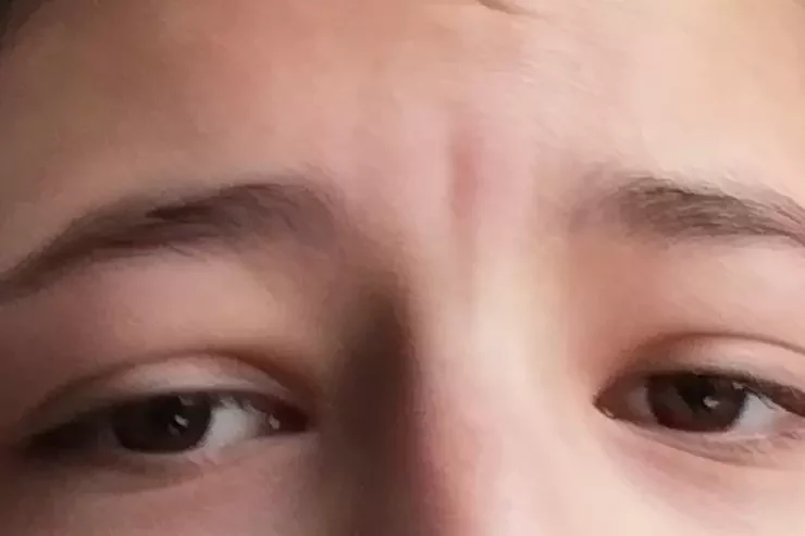 Site de démo 01 à Strasbourg