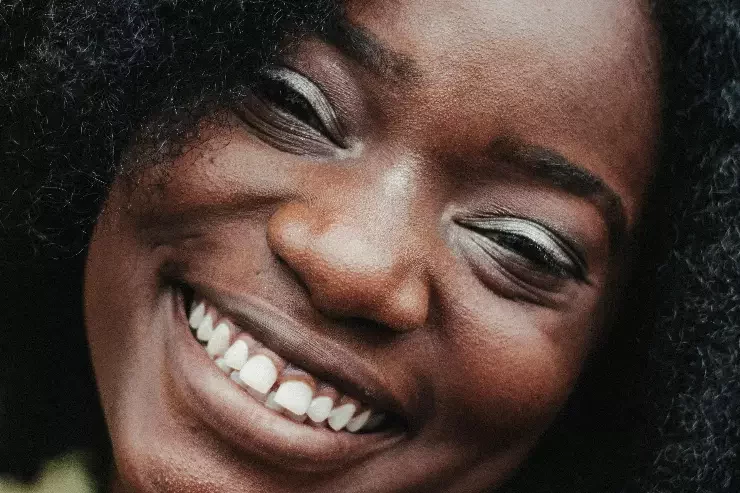 Site de démo 01 à Strasbourg