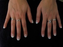 Proth&egrave;ses ongulaires des mains