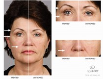 AgeLOC, la science anti-&acirc;ge de NUSKIN