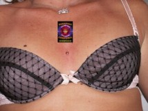 POSE D'IMPLANT MICRODERMAL à Montgeron