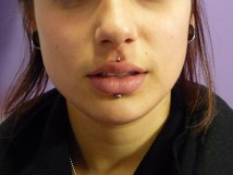 M&eacute;dusa (haut), labret (bas)
