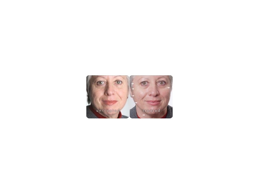 Soin anti-age à Étampes