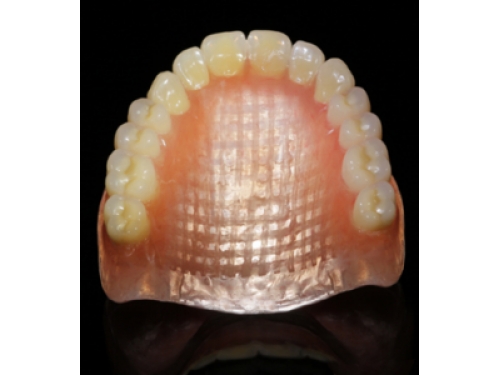 Proth&egrave;ses en r&eacute;sine avec renfort fibre