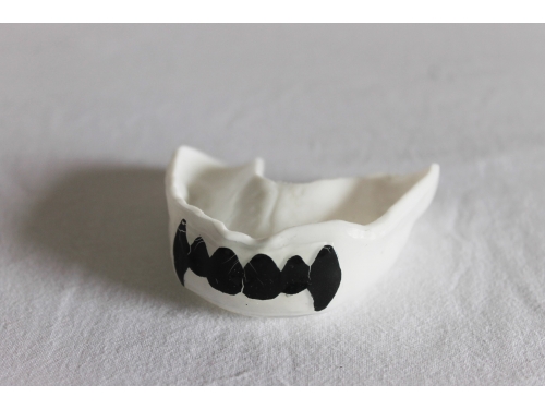 Prot&egrave;ges dents